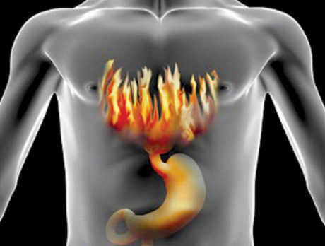 Belly fat increases risk of serious esophagus disease