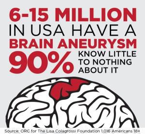 Do You Know the Warning Signs of a Brain Aneurysm?