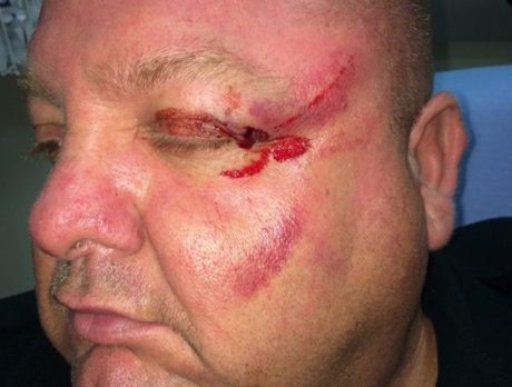 Deputy injured in attempted choking