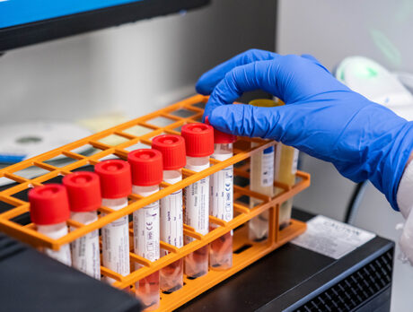 So far, so lucky as county dodges flu-season wallop